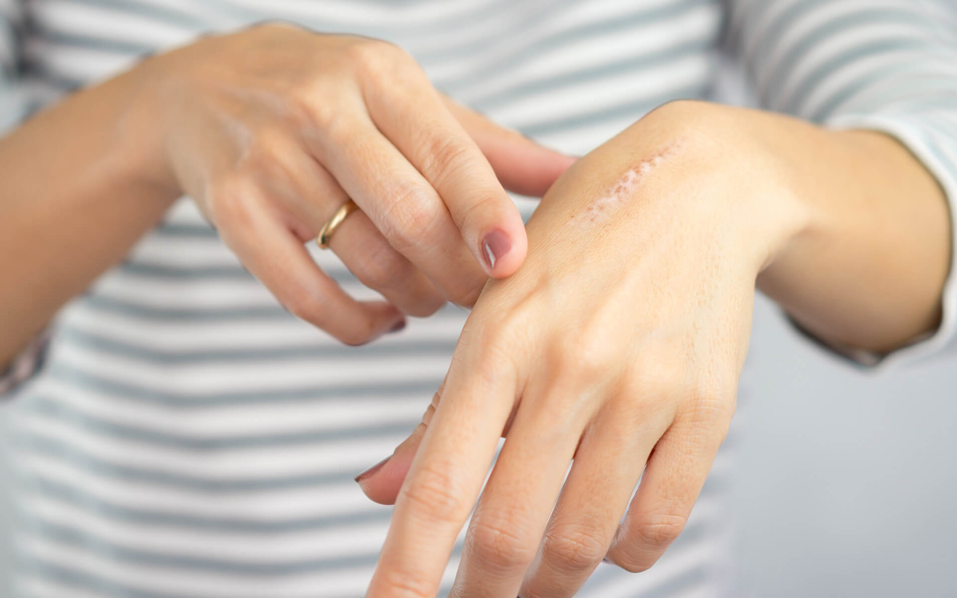 ARSA - IFAR - Web page – Skin Wounds - Post-Surgical Wounds-banner (1)