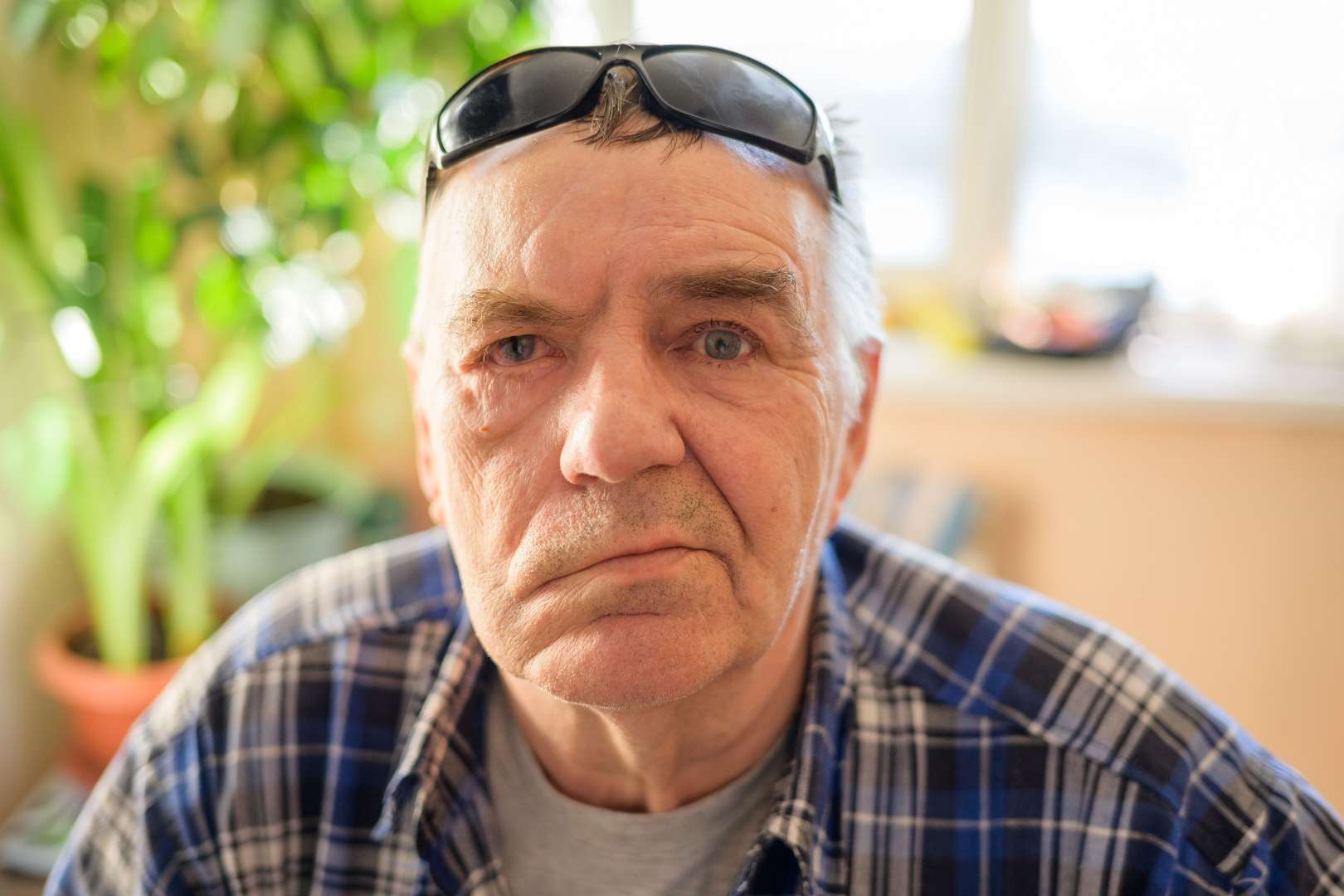 IFAR - Facial Paralysis - Symptoms (1)