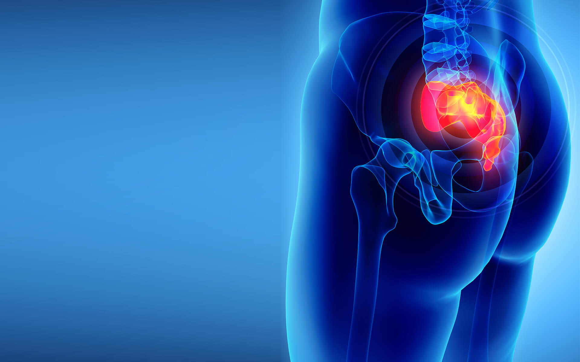 Pilonidal sinus: Symptoms, pictures, and treatment