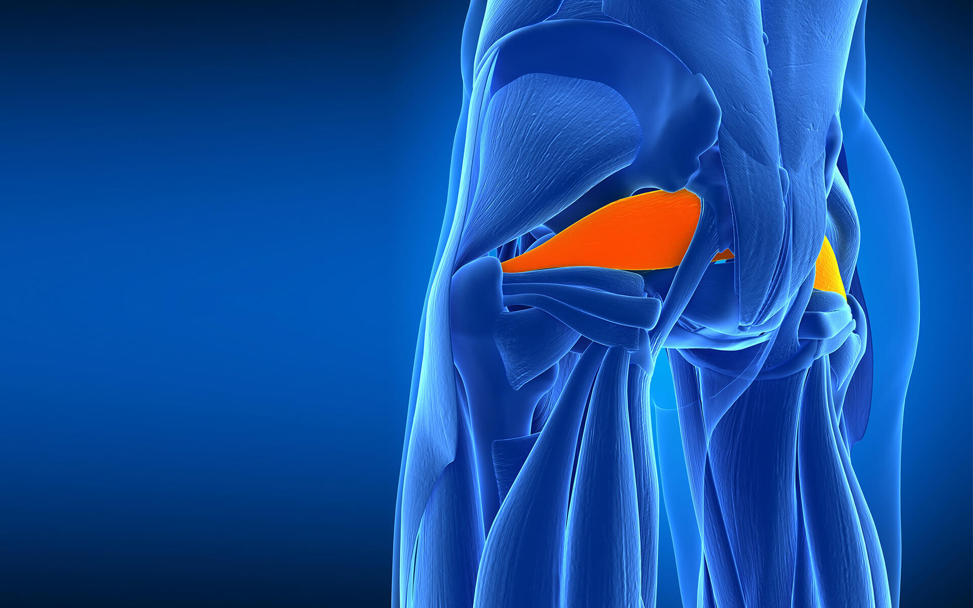 piriformis-syndrome-buttocks