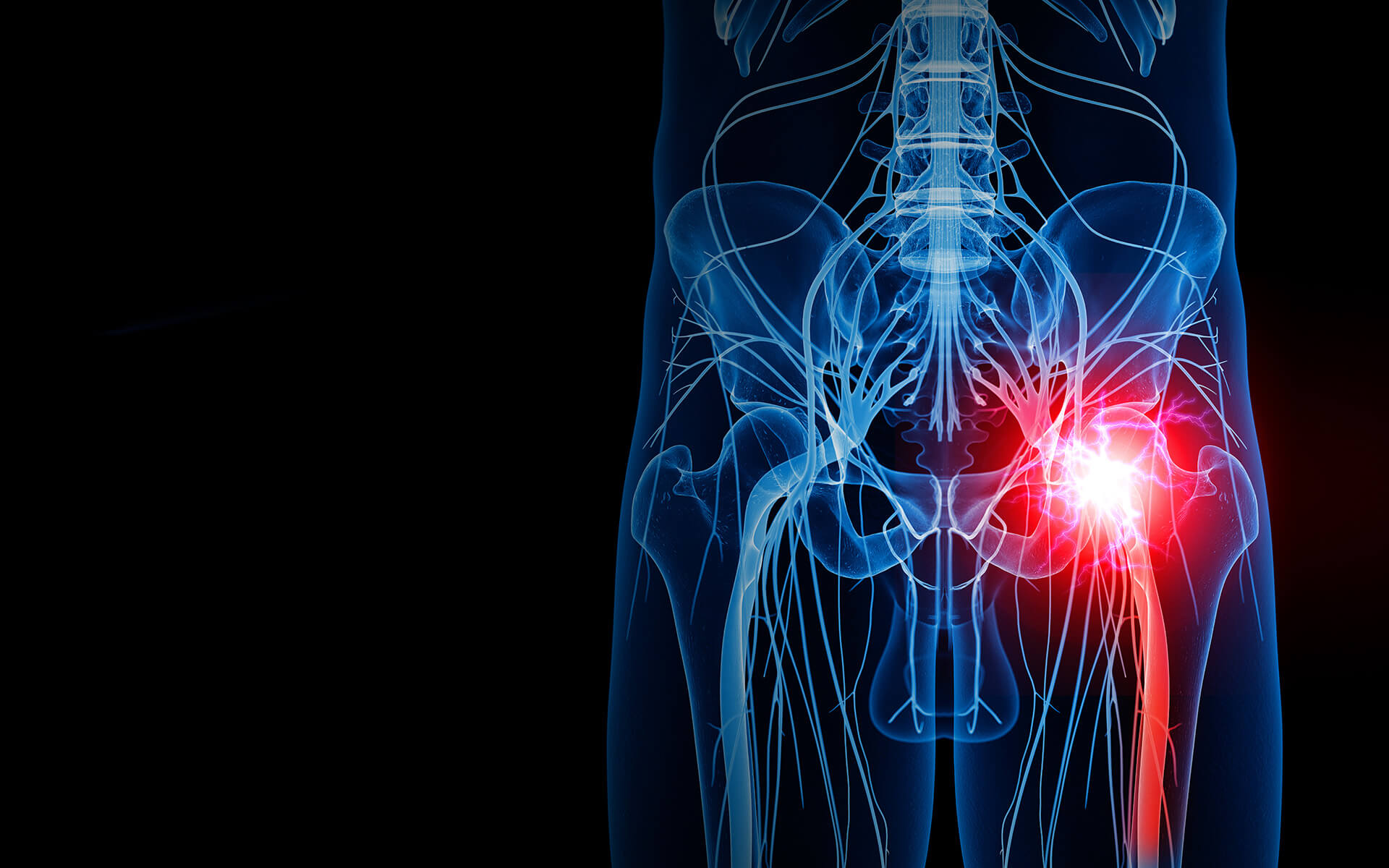 Pudendal Neuralgia and Pelvic Pain - Ortho Regenerative - The Top  Regenerative Medicine Center in Washington