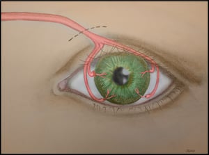 eye diagram