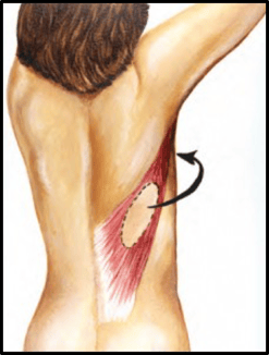 Latissimus Dorsi Flap