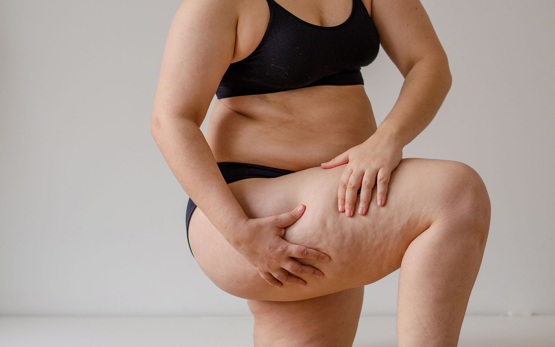 Understanding Lipedema
